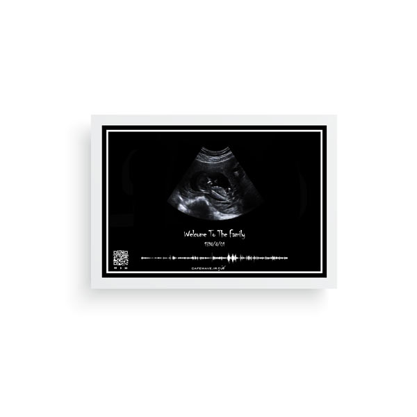 تابلو سونوگرافی نوزاد قاب سفید افقی